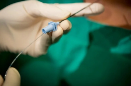 انتخاب روش مناسب تسکین درد زایمان