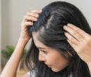 هورمون‌ها و ریزش مو: آیا مشکل از درون بدن است؟