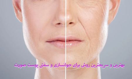 هایفوتراپی بهترین و سریعترین روش برای جوانسازی و سفتی پوست صورت هایفوتراپی بهترین و سریعترین روش برای جوانسازی و سفتی پوست صورت