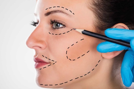 بهترین سن برای انجام لیفت صورت