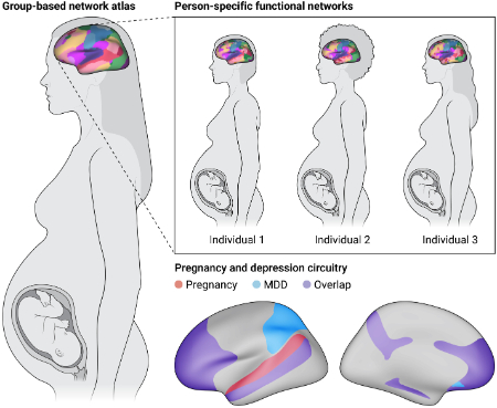 افسردگی دوران بارداری و تکامل عصبی جنین
