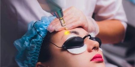 عوارض پاک کردن تاتو ابرو با لیزر