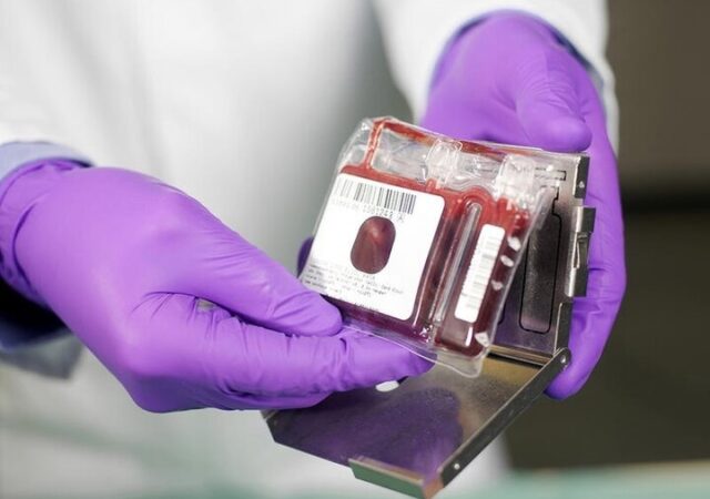 ذخیره سازی ۱۵۰۰ نمونه خون بندناف در جنگ رمضان