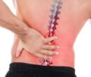 دیسک کمر را چگونه میتوان درمان کرد؟ دیسک کمر را چگونه میتوان درمان کرد؟