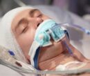 ضربه به سر ممکن است سلامت روده را مختل کند