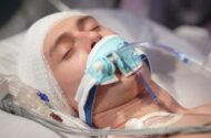 ضربه به سر ممکن است سلامت روده را مختل کند