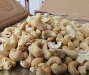 درمان آلرژی به بادام زمینی با پیوند مدفوع درمان آلرژی به بادام زمینی با پیوند مدفوع