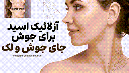 آزلائیک اسید برای بهبود جوش و جای جوش و لک آزلائیک اسید برای بهبود جوش و جای جوش و لک