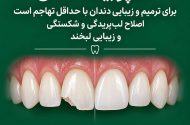 ایمپلنت، کامپوزیت یا لمینت، هر کدام برای چه مشکلی مناسب هستند؟