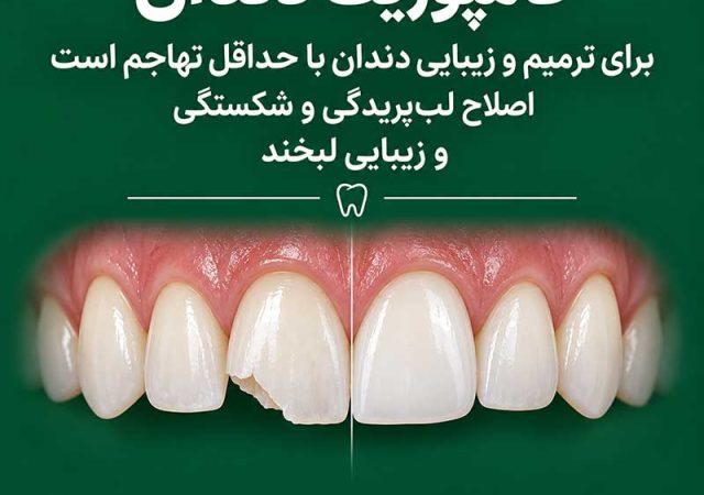 ایمپلنت، کامپوزیت یا لمینت، هر کدام برای چه مشکلی مناسب هستند؟