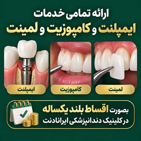 ایمپلنت، کامپوزیت یا لمینت، هر کدام برای چه مشکلی مناسب هستند؟ ایمپلنت، کامپوزیت یا لمینت، هر کدام برای چه مشکلی مناسب هستند؟