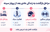 زندگی بعد از پروتز سینه؛ از مراقبت تا نتیجه نهایی
